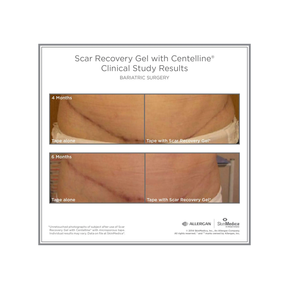SkinMedica Scar Recovery Gel with Centelline®